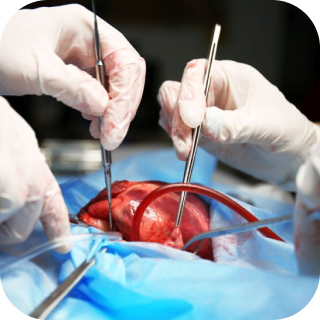 Операция по трансплантации сердца